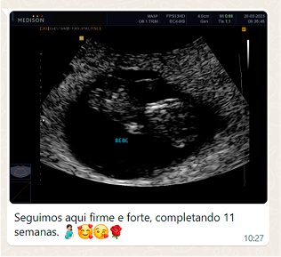 COLUNA 2